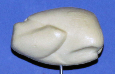 Woodcock