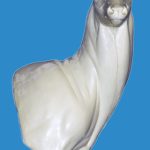 94-6218R Full Wall Pedestal