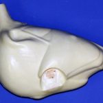 CFT175 Walking/ Erect with Neck Base