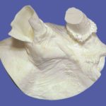 Complete Ear Butt Study