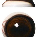 DP34M Defined Cornea Pre Rotated with Veins Medium 34 MM