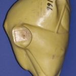 CFT166 Turkey - Walking